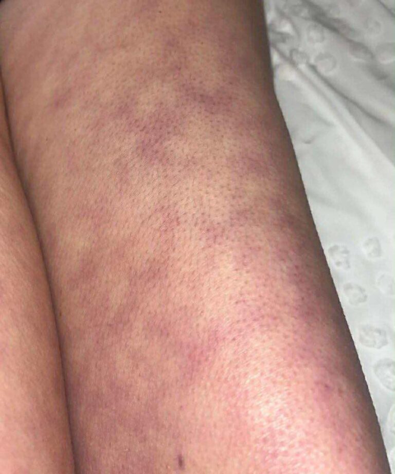 541286369_122236903682157339_1074376337281408353_n